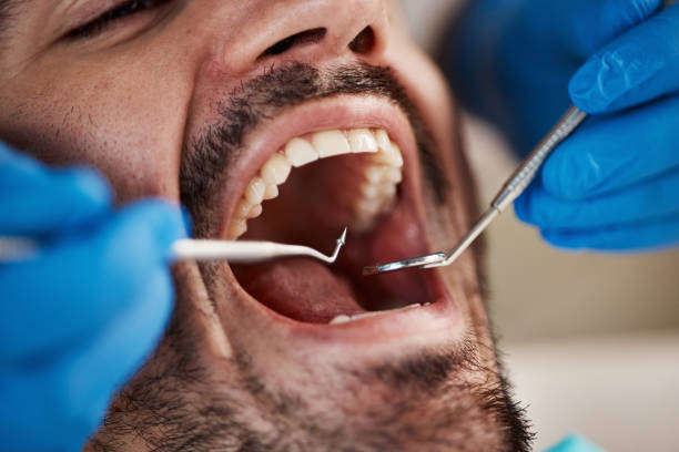 Best Emergency Root Canal Therapy in Guntown, MS